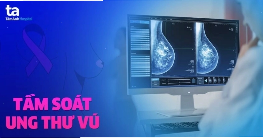 Gói tầm soát ung thư vú toàn diện