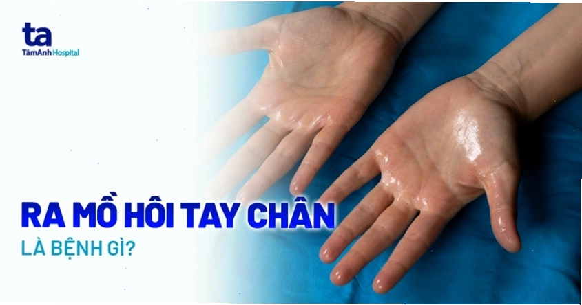 Hiện tượng đổ mồ hôi tay chân