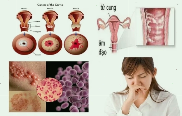Hiện tượng rong kinh có mùi hôi