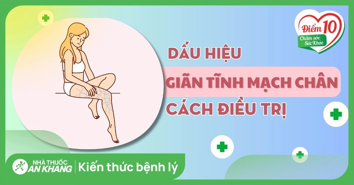 Hiểu đúng về bệnh suy giãn tĩnh mạch chân là gì và các nguy cơ tiềm ẩn