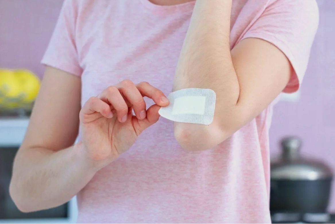 Hiểu về vết bầm tím