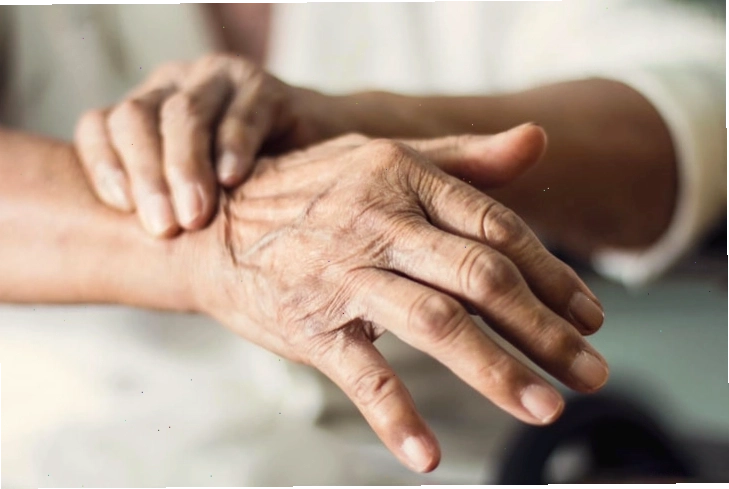 Hình ảnh bệnh Parkinson