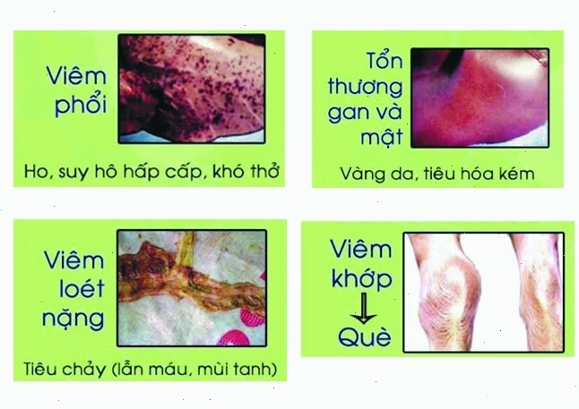 Hình ảnh bệnh tích phó thương hàn