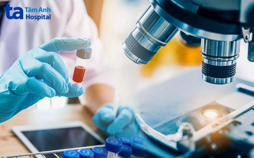 Hình ảnh chẩn đoán bệnh viêm túi thừa