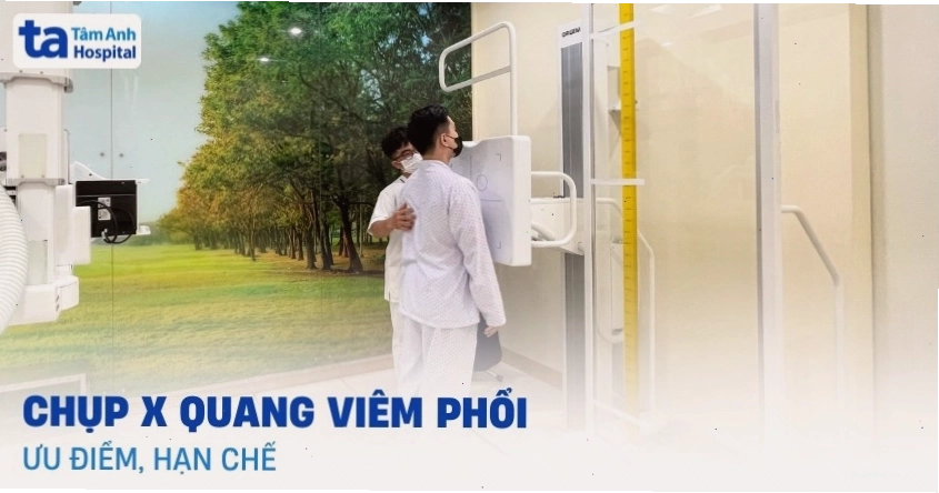Hình ảnh chụp X-quang phổi chẩn đoán viêm phổi