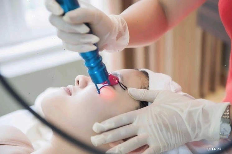 Hình ảnh điều trị mụn thịt bằng công nghệ laser