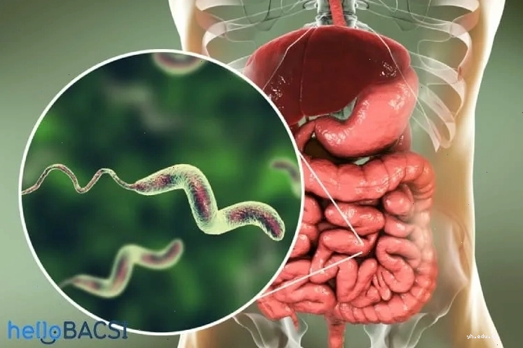Hình ảnh hiển thị vi khuẩn Campylobacter jejuni dưới kính hiển vi điện tử