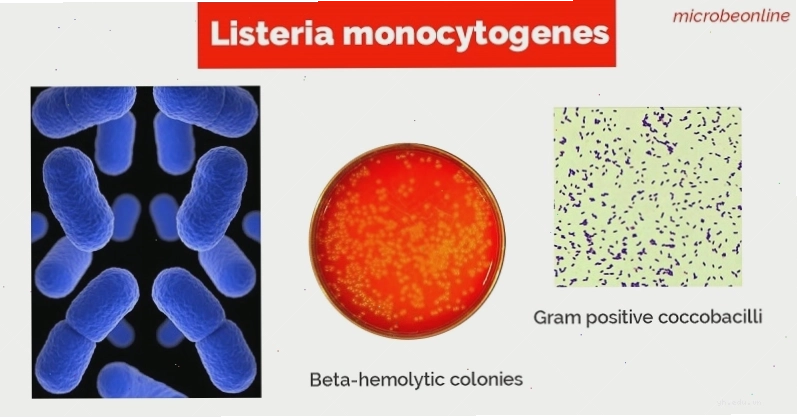 Hình ảnh hiển vi của vi khuẩn Listeria monocytogenes