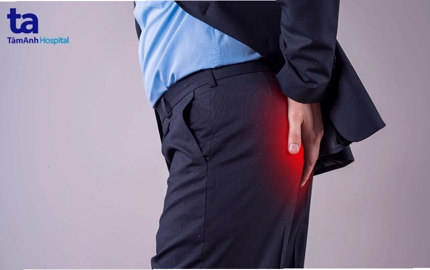 Hình ảnh khối polyp phát triển tại hậu môn
