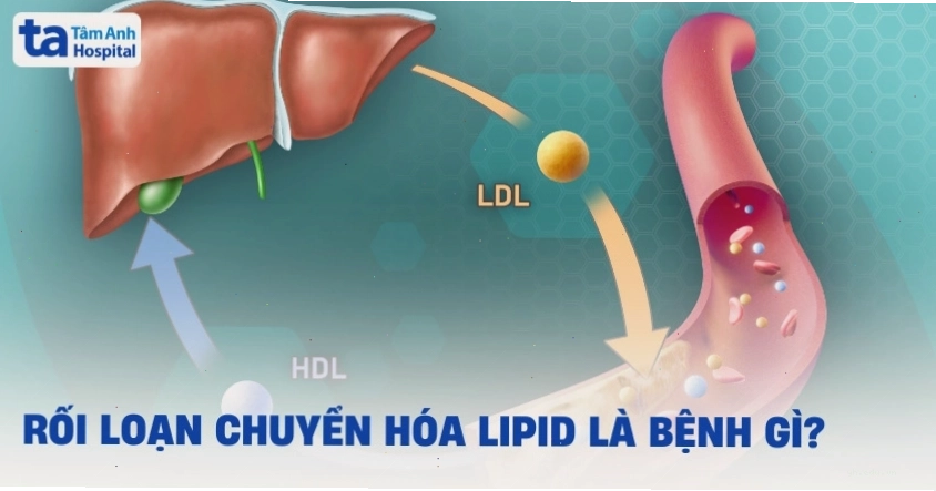 Hình ảnh minh họa cấu trúc lipid trong mạch máu người