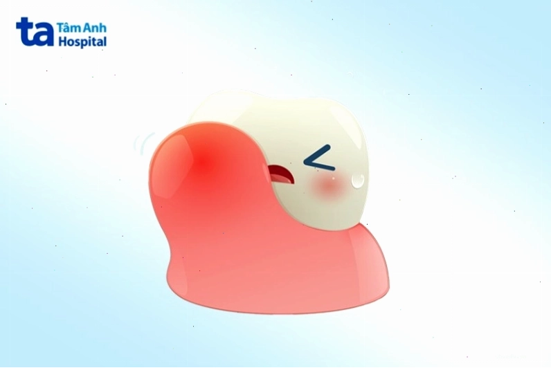 Hình ảnh minh họa cấu trúc nha chu bao quanh chân răng