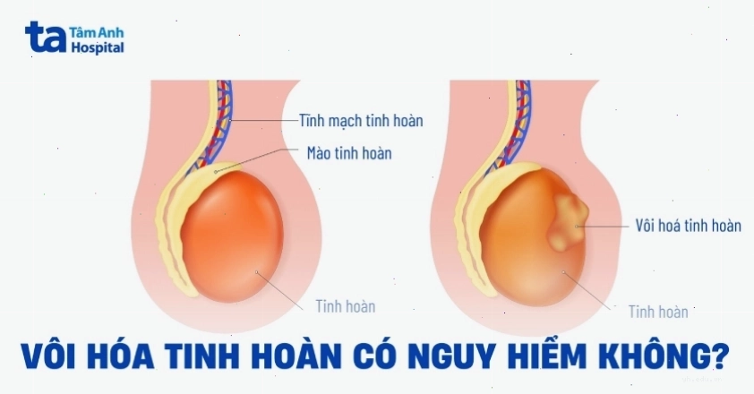Hình ảnh minh họa kiểm tra sức khỏe nam khoa