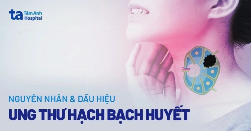 Hình ảnh minh họa lối sống lành mạnh và thực phẩm bổ dưỡng