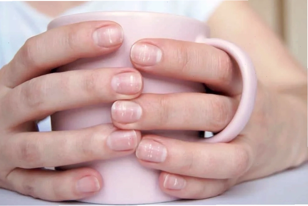 Hình ảnh minh họa móng tay xuất hiện đốm trắng bất thường