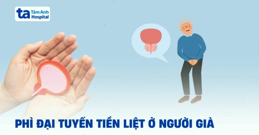 Hình ảnh minh họa người cao tuổi cần theo dõi sức khỏe tiền liệt tuyến