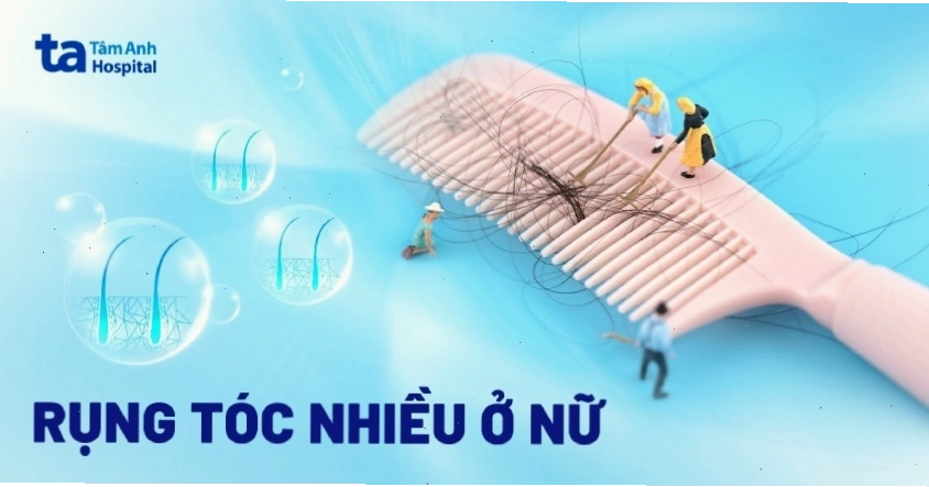 Hình ảnh minh họa phụ nữ gặp tình trạng rụng tóc nhiều cần được quan tâm