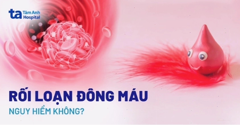 Hình ảnh minh họa rối loạn đông máu