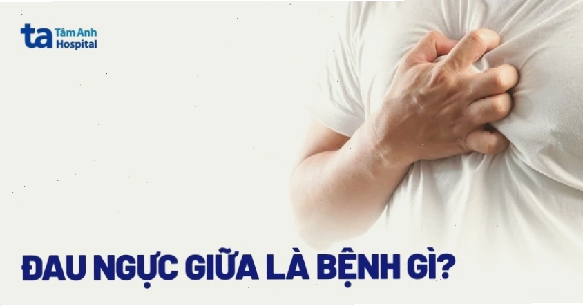 Hình ảnh minh họa thắc mắc đau ngực giữa là bệnh gì
