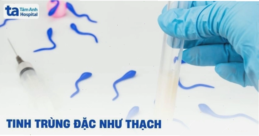 Hình ảnh minh họa tinh dịch có dạng đặc như thạch