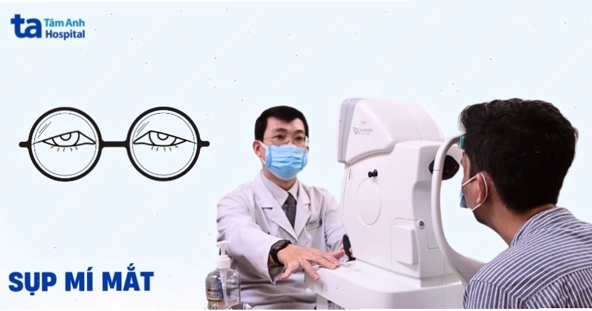 Hình ảnh minh họa tình trạng sụp mí mắt ở người trưởng thành