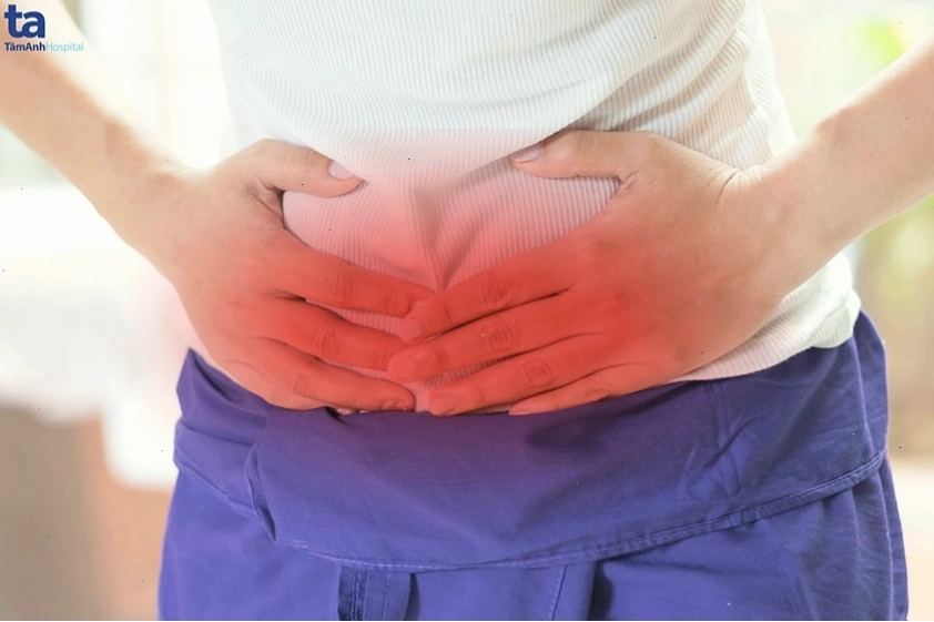Hình ảnh minh họa tình trạng viêm ruột