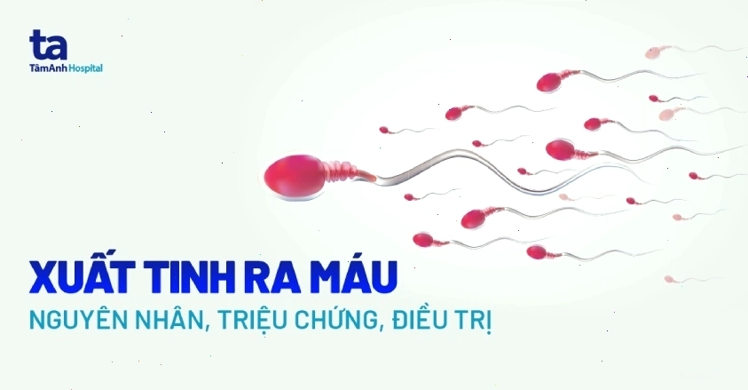 Hình ảnh minh họa tình trạng xuất tinh ra máu ở nam giới