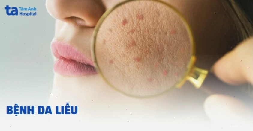 Hình ảnh minh họa tổng quan về các bệnh da liễu thường gặp trên cơ thể người
