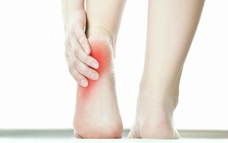 Hình ảnh minh họa triệu chứng đau nhức vùng gót chân khi di chuyển