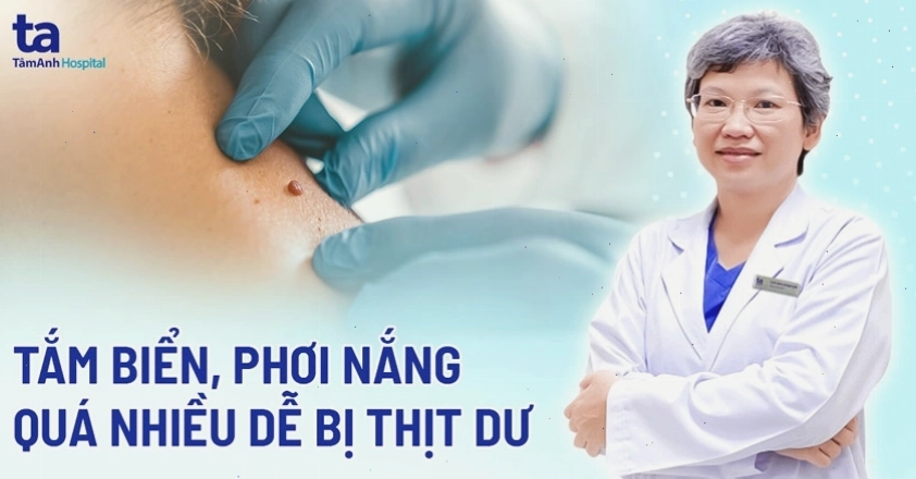 Hình ảnh minh họa u mềm treo trên bề mặt da