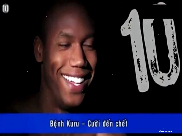 Hình ảnh minh họa về các căn bệnh cực hiếm trên thế giới