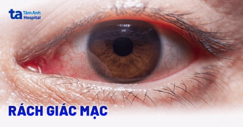 Hình ảnh minh họa về chăm sóc sức khỏe