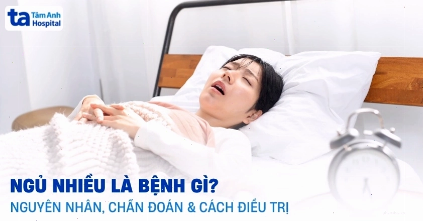Hình ảnh minh họa về tình trạng ngủ nhiều quá mức cần thiết