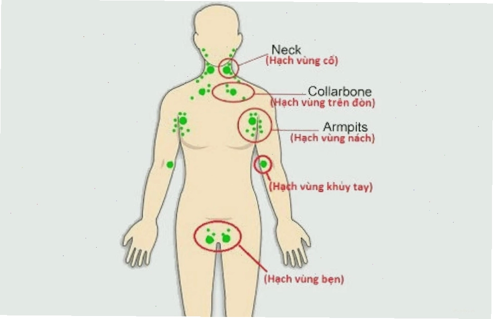 Hình ảnh minh họa vị trí hạch bạch huyết vùng bẹn