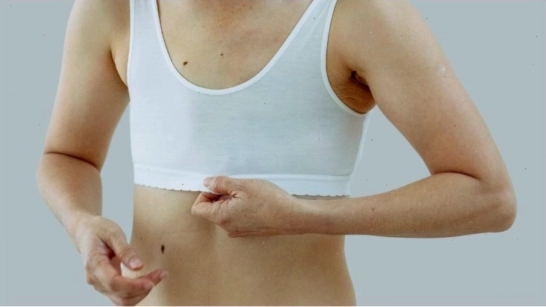 Hình ảnh mô phỏng làn da sáng màu bất thường so với tông màu da khỏe mạnh
