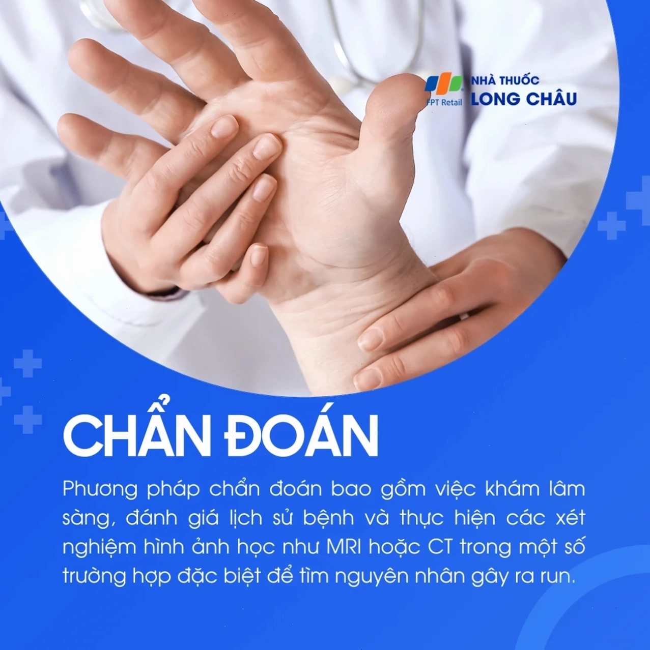 Hình ảnh mô phỏng quá trình run rẩy