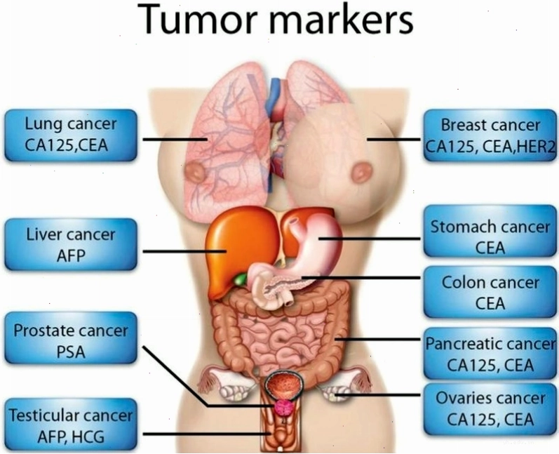 Hình ảnh mô phỏng sự phát triển của các khối u trong cơ thể