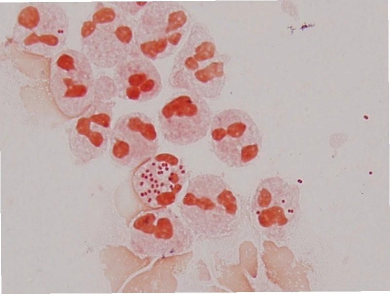 Hình ảnh mô phỏng vi khuẩn Moraxella catarrhalis dưới kính hiển vi