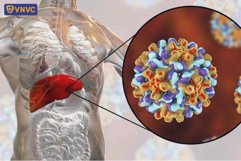 Hình ảnh mô phỏng virus viêm gan B tấn công tế bào gan người