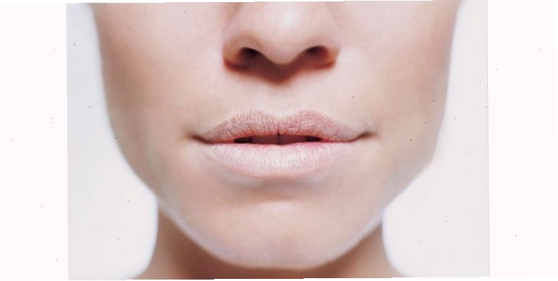 Hình ảnh mô tả đôi môi có sắc màu nhợt nhạt trắng bệch