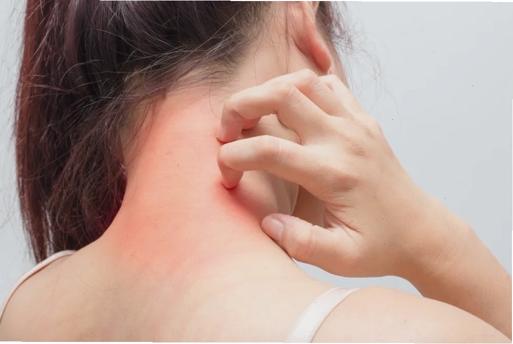 Hình ảnh mô tả trực quan vi khuẩn tụ cầu vàng MRSA dưới kính hiển vi