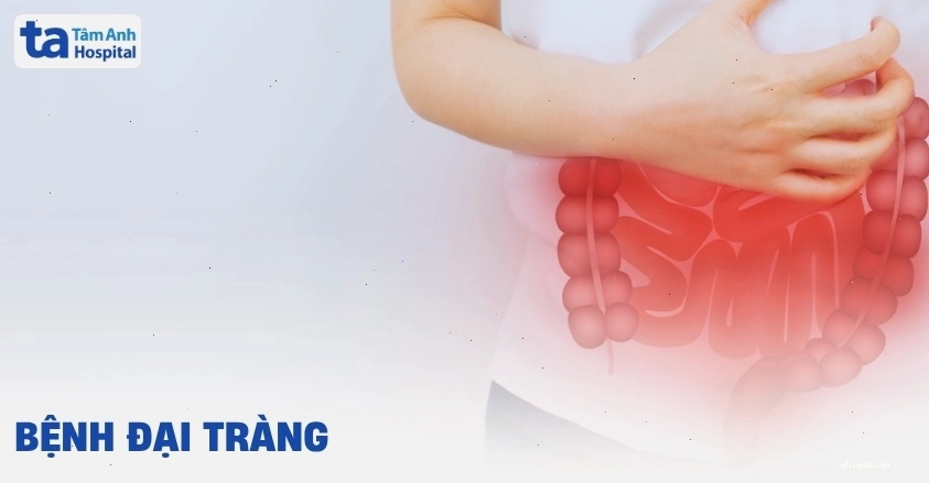 Hình ảnh nội soi đại tràng hiển thị niêm mạc bình thường và bị viêm