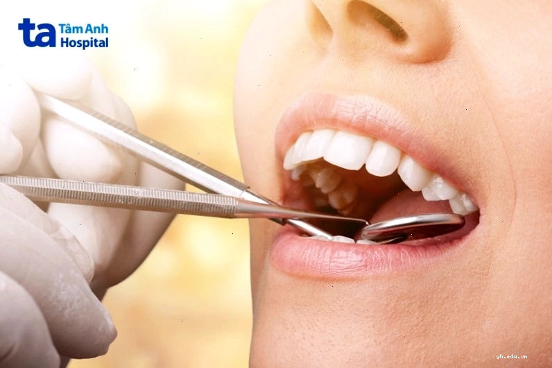 Hình ảnh răng bị tổn thương do nha chu