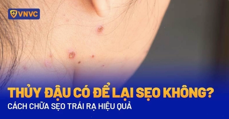 Hình ảnh sẹo sau khi bị phỏng dạ nặng