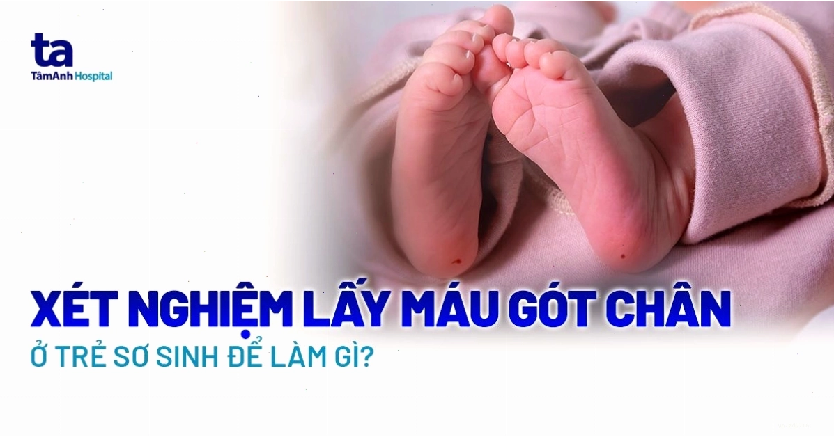 Hình ảnh thực hiện xét nghiệm lấy máu gót chân