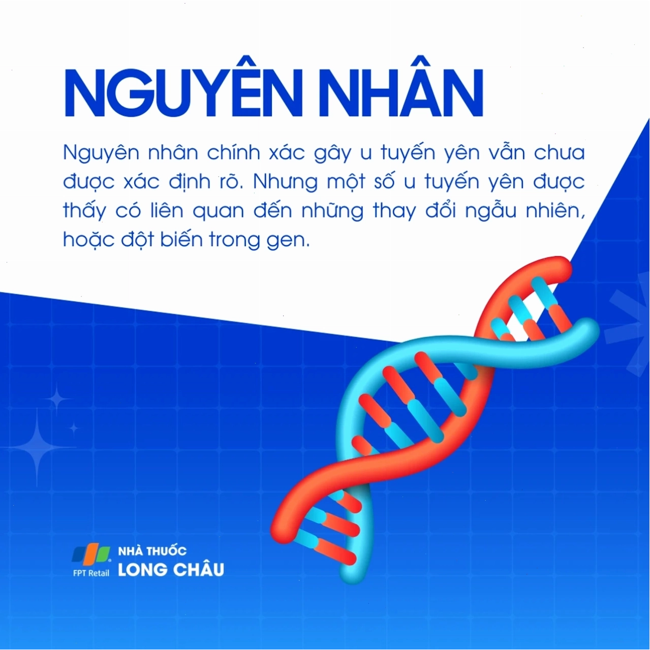 Hình ảnh u tuyến yên dạng 3