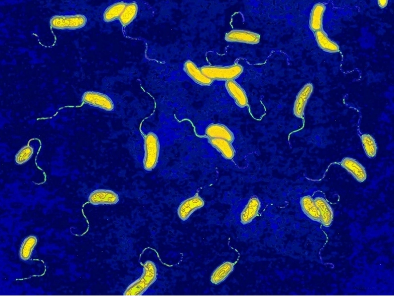 Hình ảnh vi khuẩn Vibrio Cholerae gây bệnh tả dưới kính hiển vi điện tử