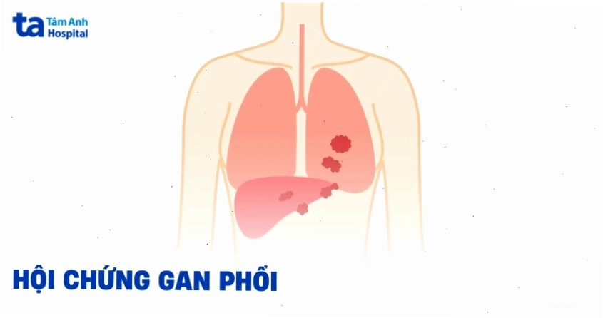 Hội chứng gan phổi