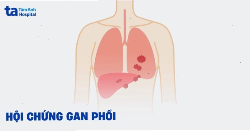 Hội chứng gan phổi nguy hiểm