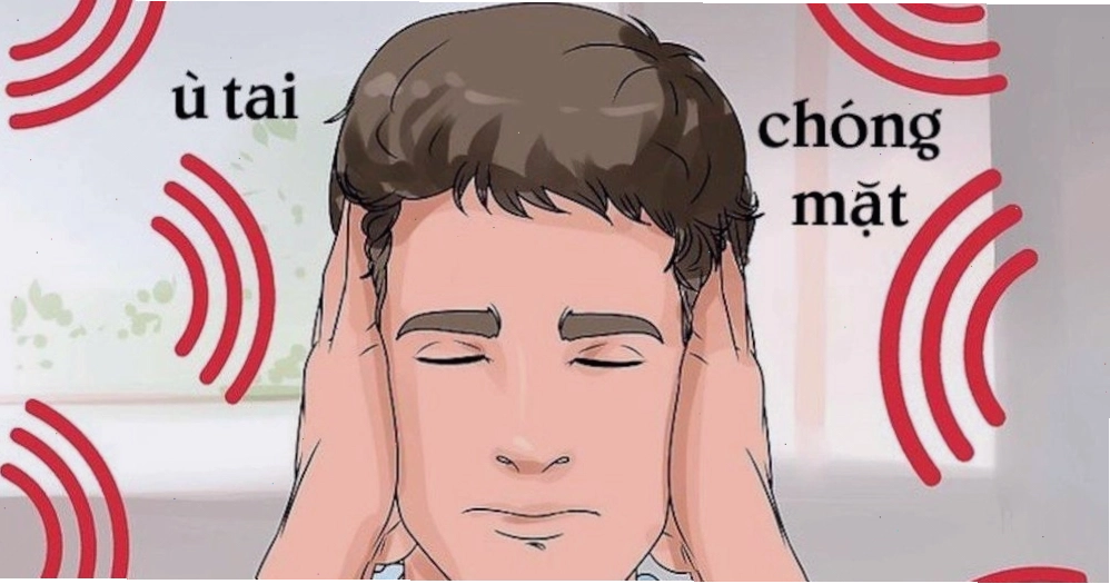 Hội chứng Meniere gây choáng váng