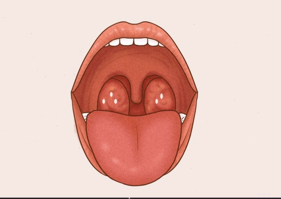 Hơi thở có mùi lạ là dấu hiệu cần lưu ý
